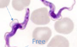 <p>What parasite is this?</p>