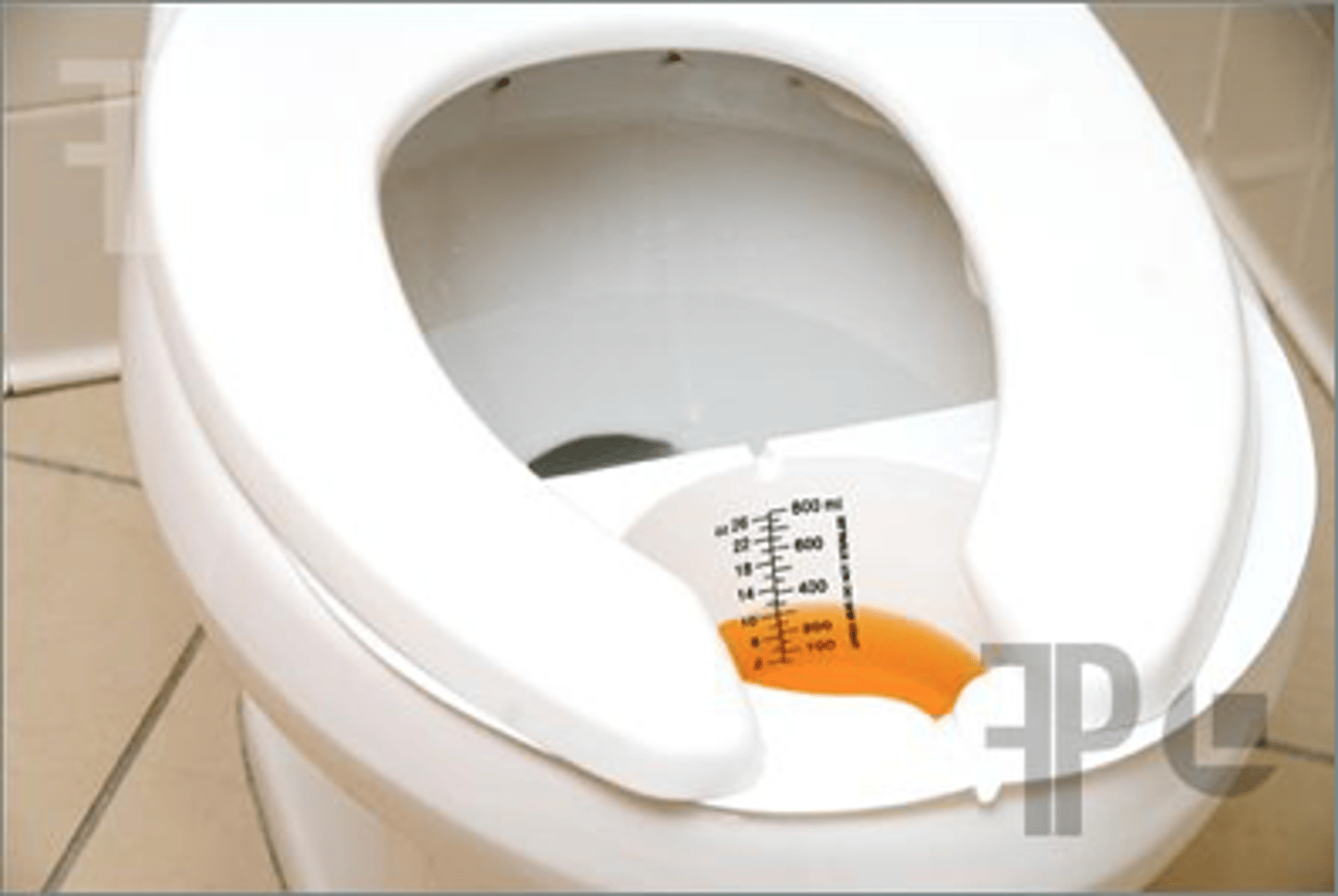 <p>Urine sample collected in the middle of a flow of urine</p>