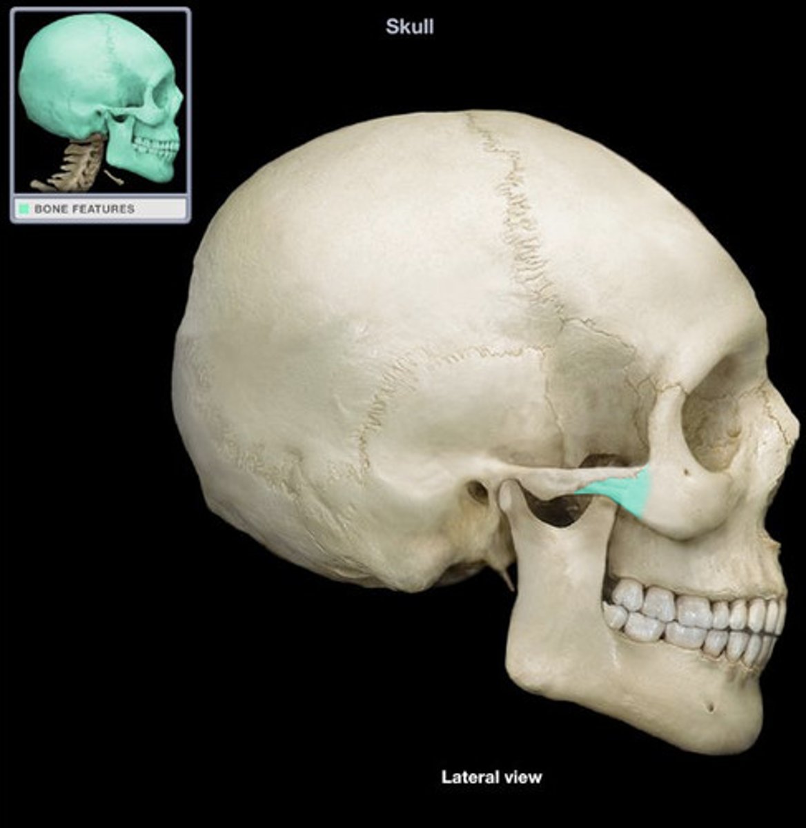 <p>Zygomatic bone</p>