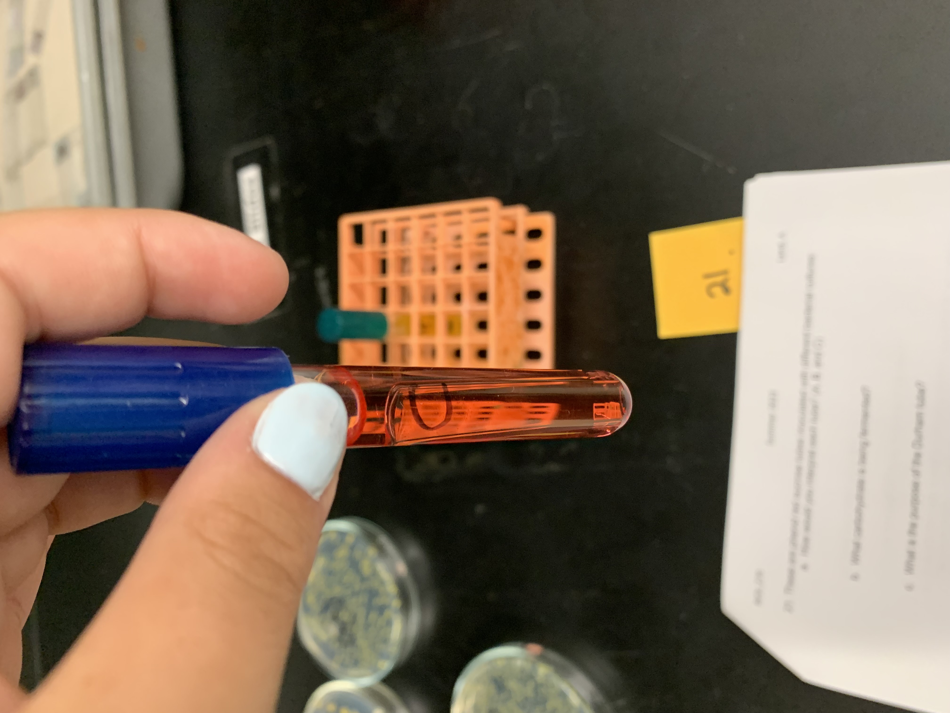 <p>(Phenol red sucrose tube) interpret the tube</p>