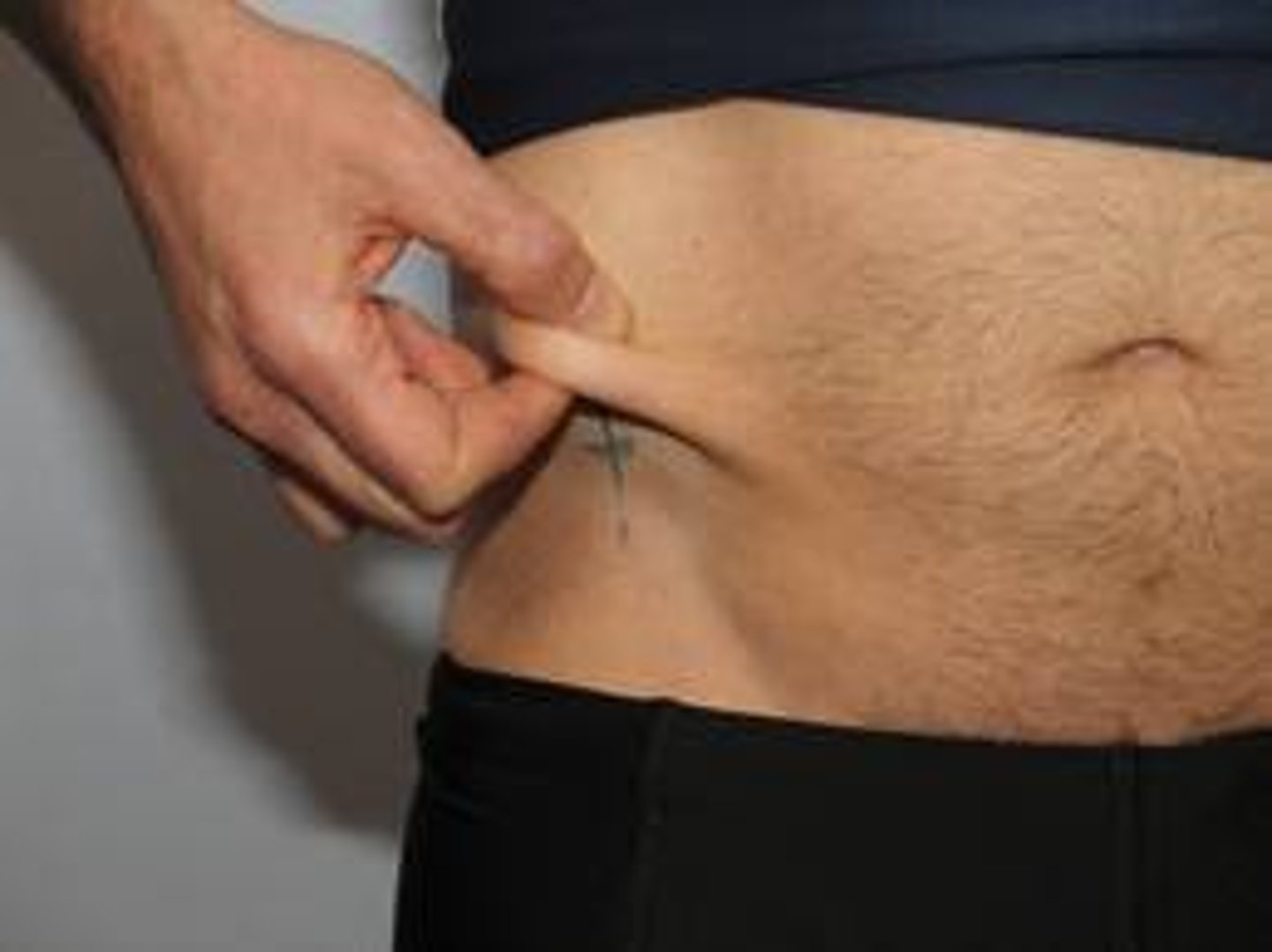 <p>In line with the natural angle of the iliac crest taken in the anterior axillary line immediately superior to the iliac crest</p><p>Diagonal</p>