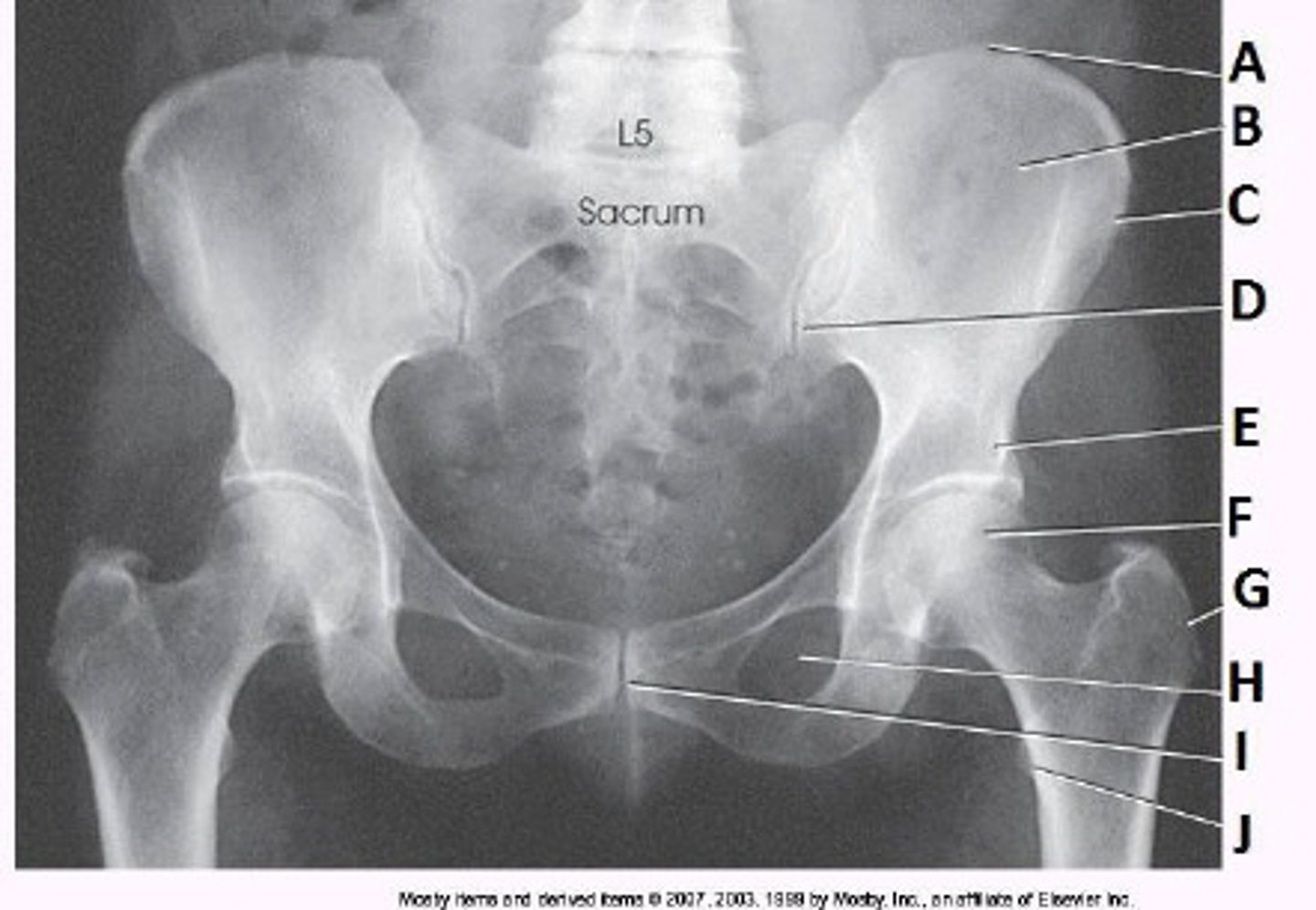 <p>What anatomy is labeled as letter C in the image below?</p>