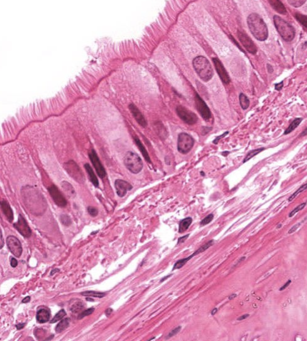 <p>Epithelial tissue that appears to be stratified because the nuclei of the epithelial cells are at different levels. However, every cell is in contact with the basement membrane, but not all cells reach the lumen.</p>
