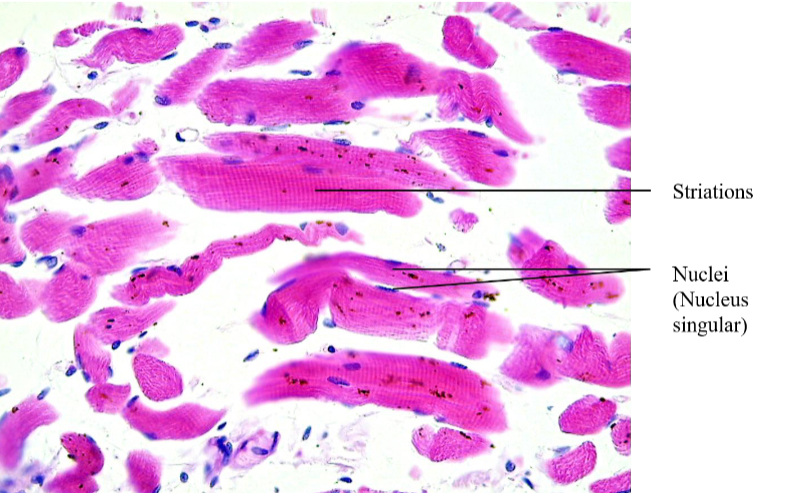 <p>What type of muscle tissue is this</p>