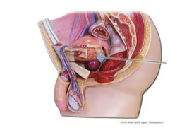 <p><span>Identify the highlighted structure</span></p>