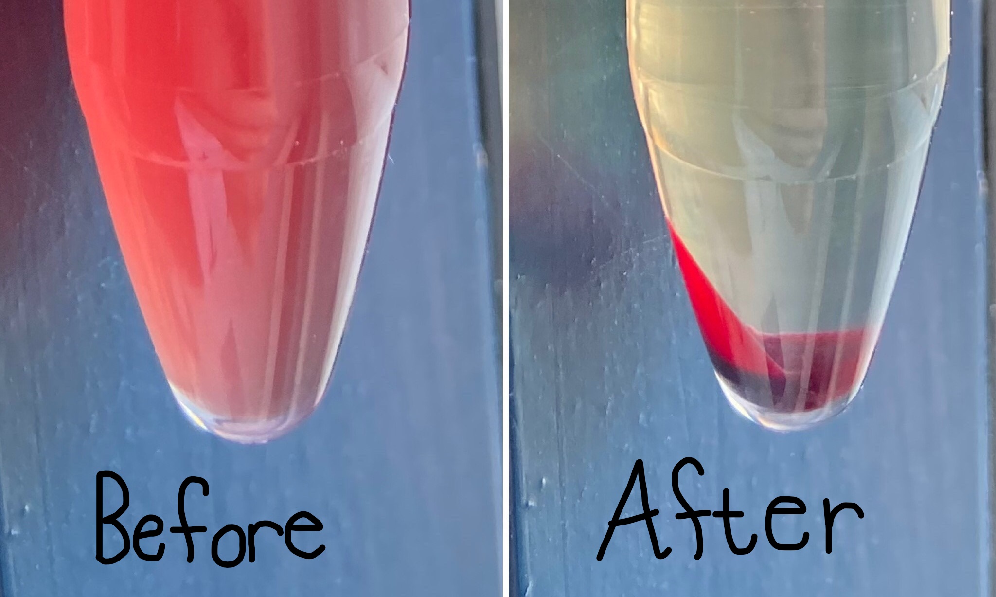 <p>You have a urine sample that appears red in color. You centrifuge that sample and notice that the supernatant loses the red color while the sediment still appears red. What is happening?</p>