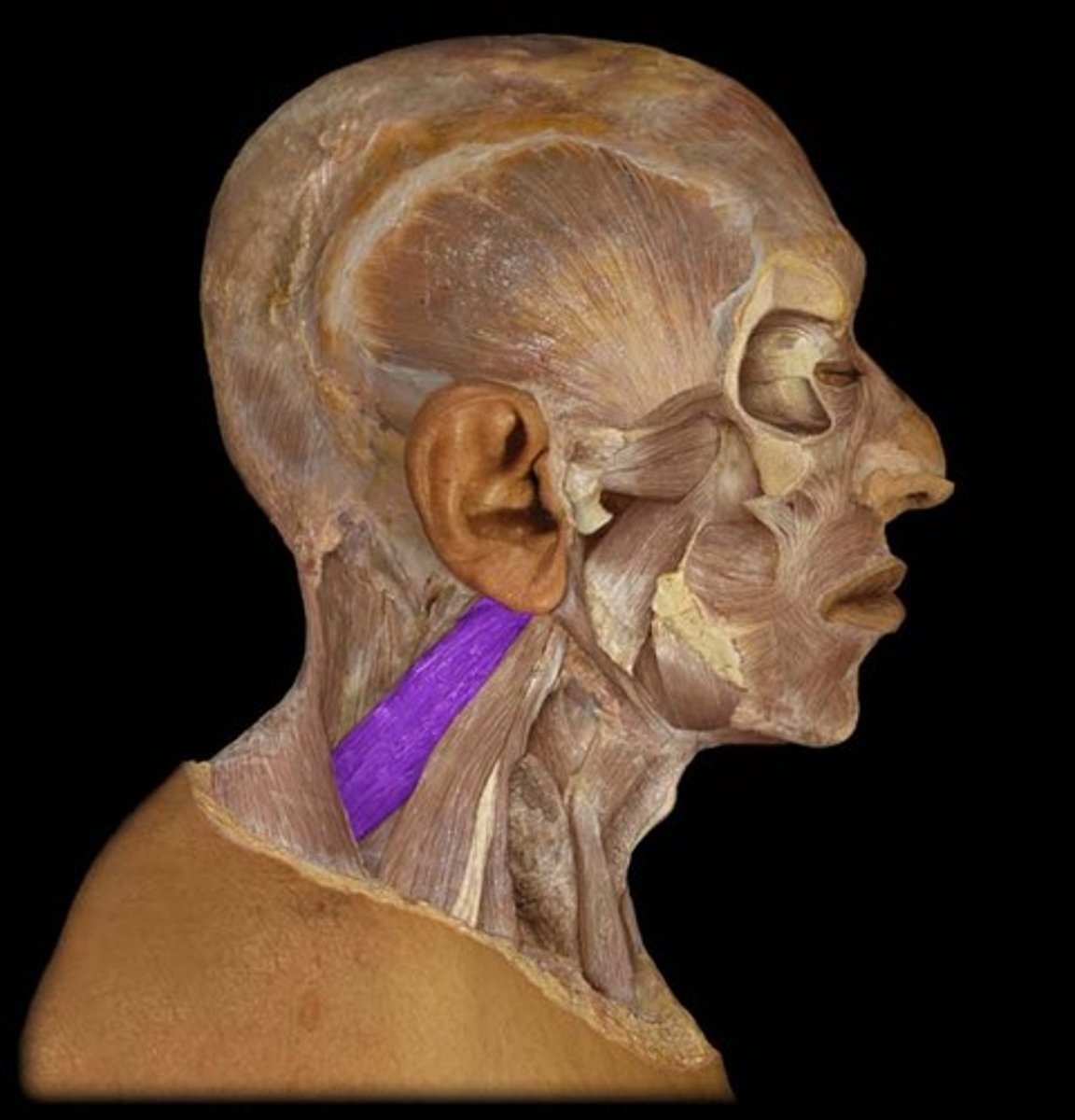 <p>Levator Scapulae Action</p>