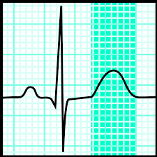 <p>What is the highlighted section</p>