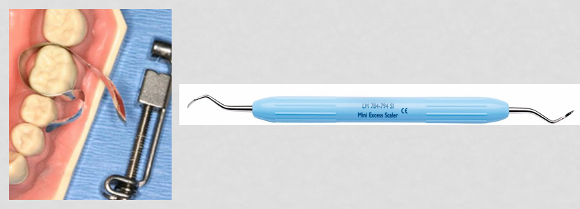 <p>-retainer removed first by loosening the outer knob</p><p>-matrix band bent away from the restoration and gently removed while the marginal ridge is stabilized by your thumb</p><p>-proximal excess can be removed with an explorer and if any gingival excess exists it can be removed with an explorer or proximal carver</p>