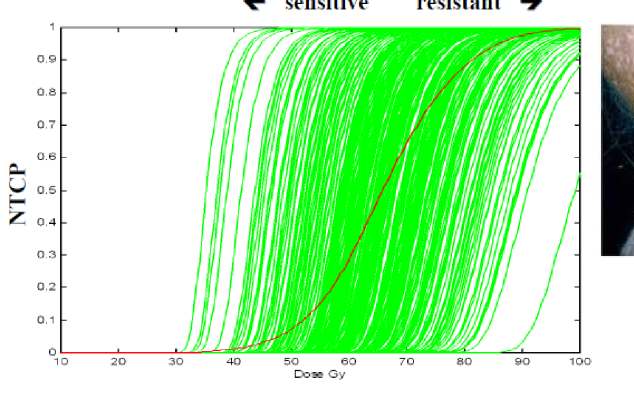 <p>complications of radiation will vary individual to individual</p>