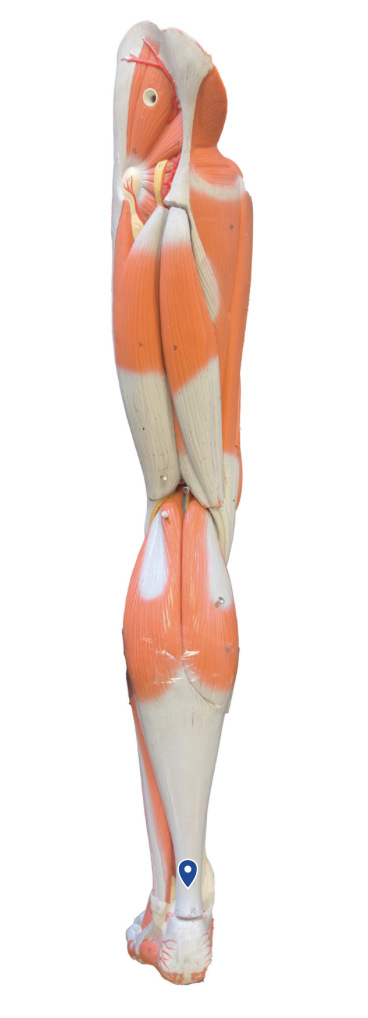 <p>What muscle is the arrow pointing to?</p>