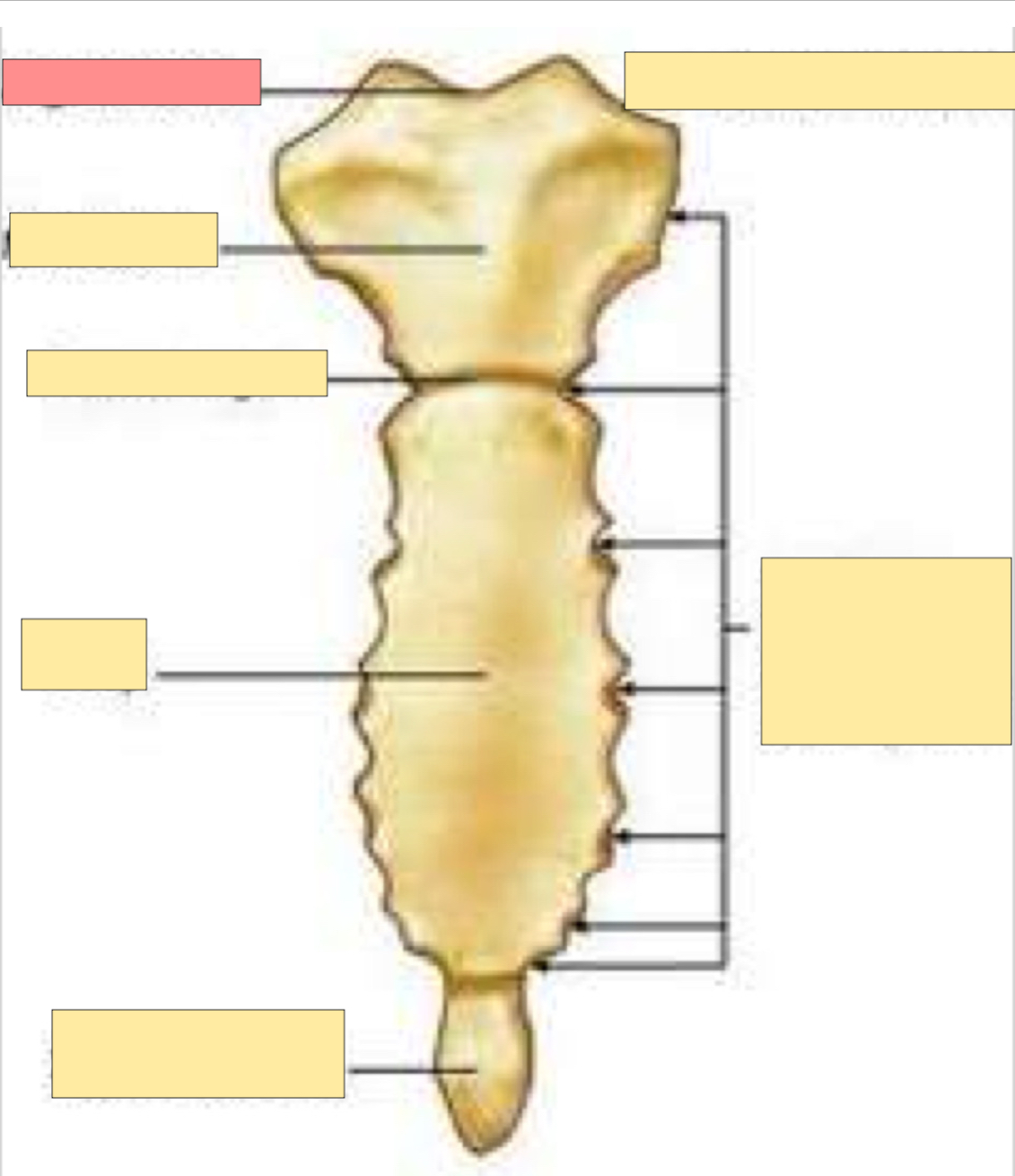 <p>What part of the sternum is this?</p>