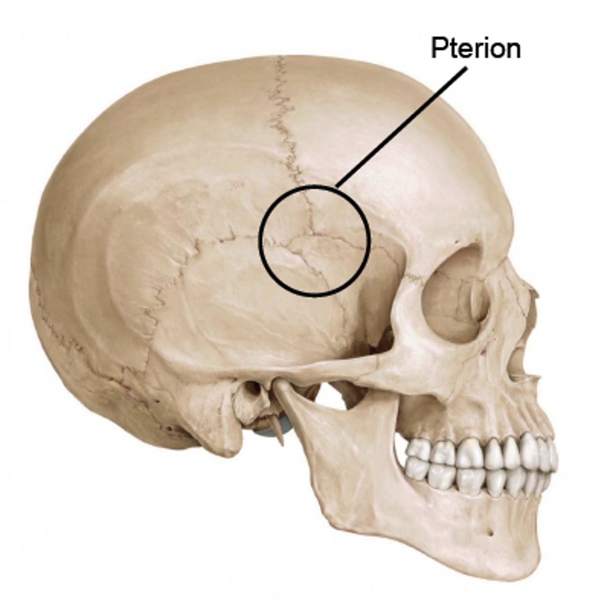 <p>o distinguishes H-shaped formation of sutures that unite the frontal, parietal, sphenoid (greater wing), and temporal bones.</p><p>§ Represents weak point in cranium, susceptible to fracture</p><p>§ Pterion fractures complicated by presence of middle meningeal artery deep to this space</p>