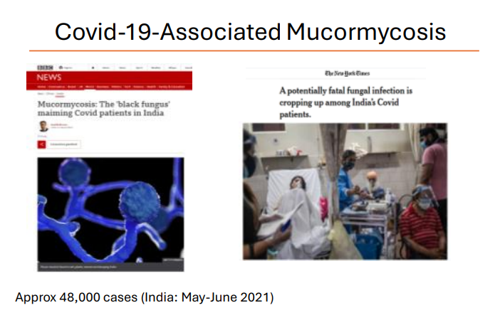 <p>in patients who have had covid - 2021</p>