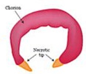 <p>diffuse</p>