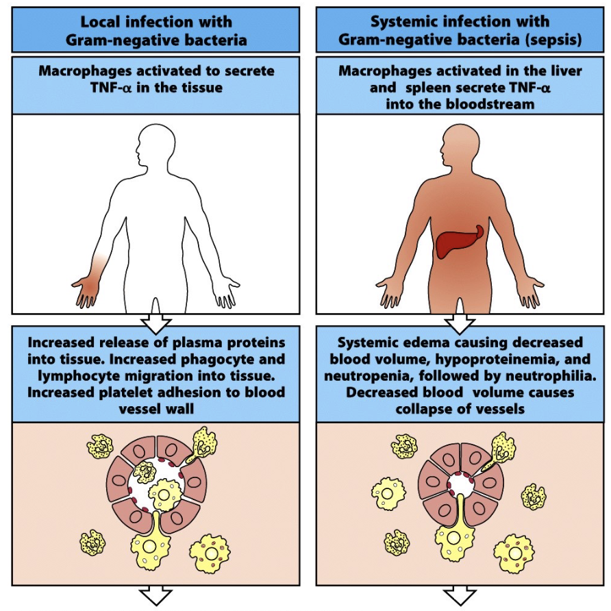 <ul><li><p><strong>Local inflammation</strong> → protective, controls pathogens, induces adaptive immunity</p></li><li><p><strong>Systemic inflammation</strong> → dangerous, can cause widespread endothelial activation, plasma leakage, organ failure → high mortality (~95%)</p></li><li><p>Fine balance needed: uncontrolled systemic response = shock, kidney/liver/brain damage</p></li><li><p>Immune deregulation = main cause of damage; proper coordination prevents this</p></li><li><p>Innate &amp; adaptive systems:</p><ul><li><p>99% protection comes from them</p></li><li><p>~90% damage can also come from them if unregulated</p></li></ul></li></ul><img src="https://knowt-user-attachments.s3.amazonaws.com/3fbccef5-d731-4427-a8f8-7bc509aca767.png" data-width="100%" data-align="center"><p></p>