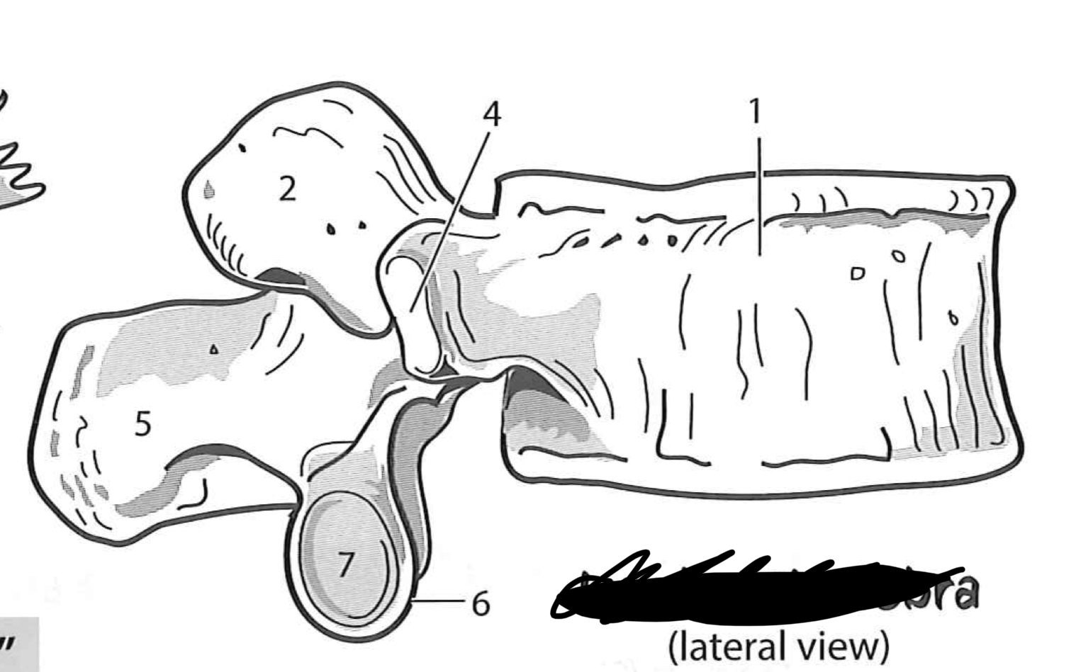 <p>Lumbar vertebrae</p>