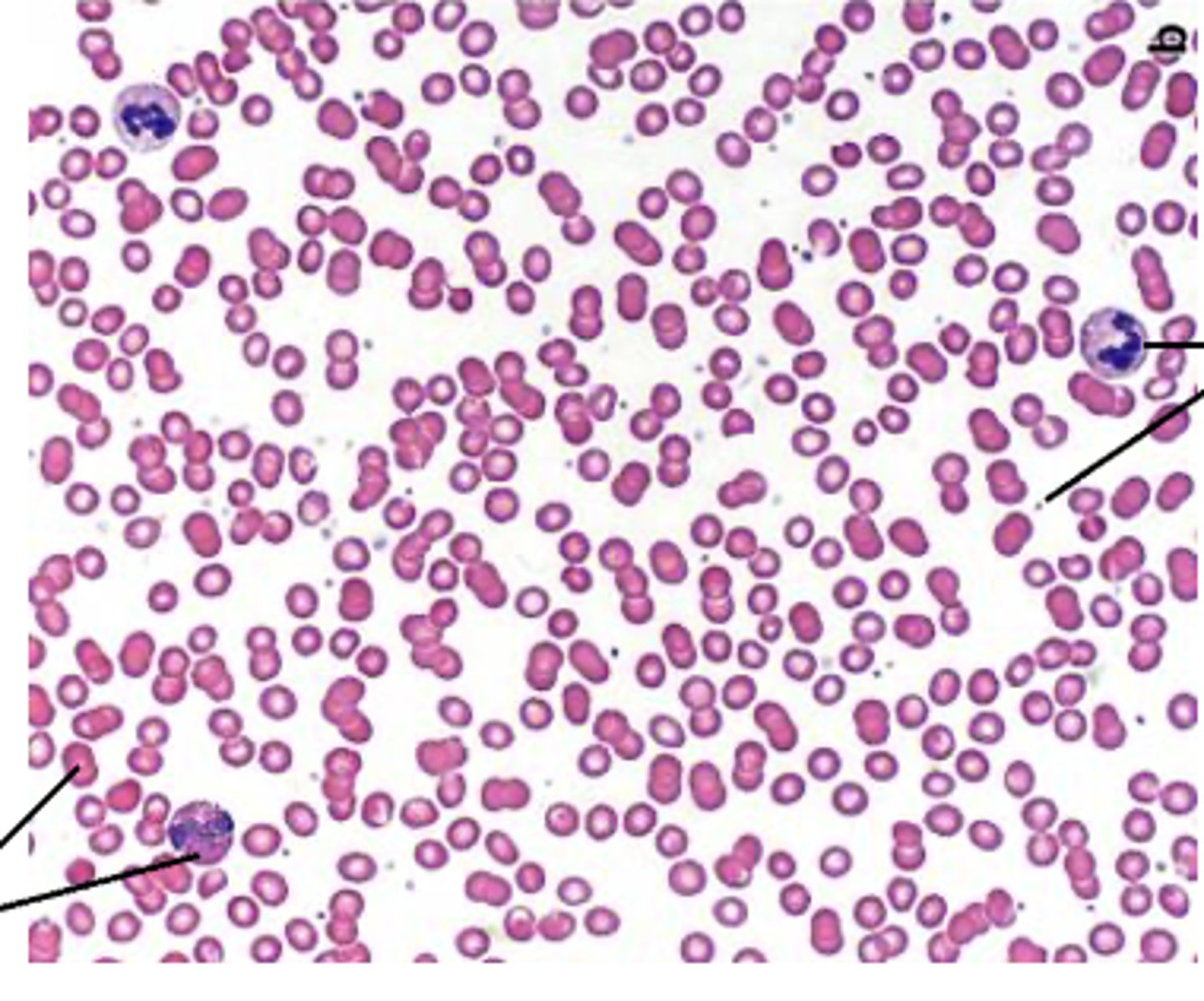 <p>What type of stain?</p>