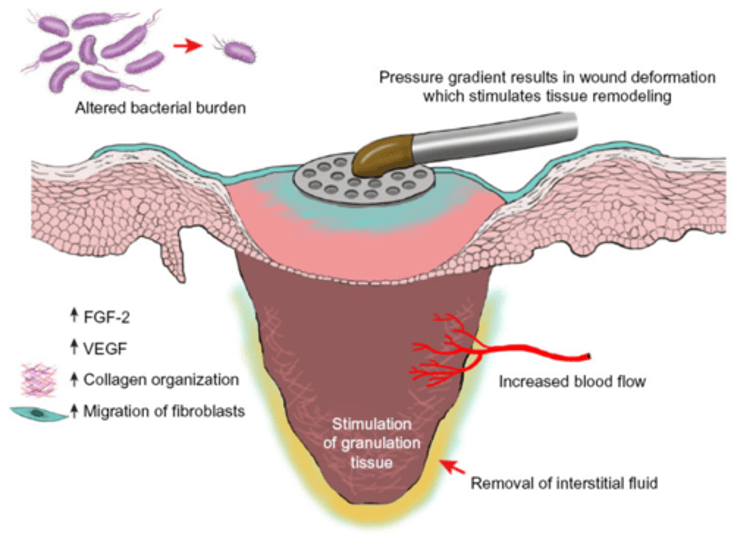 <p>-reduces bacterial colonisation</p><p>-promotes granulation tissue development</p><p>-increases rate of cell mitosis</p><p>-spurs migration of epithelial cells within wound</p>