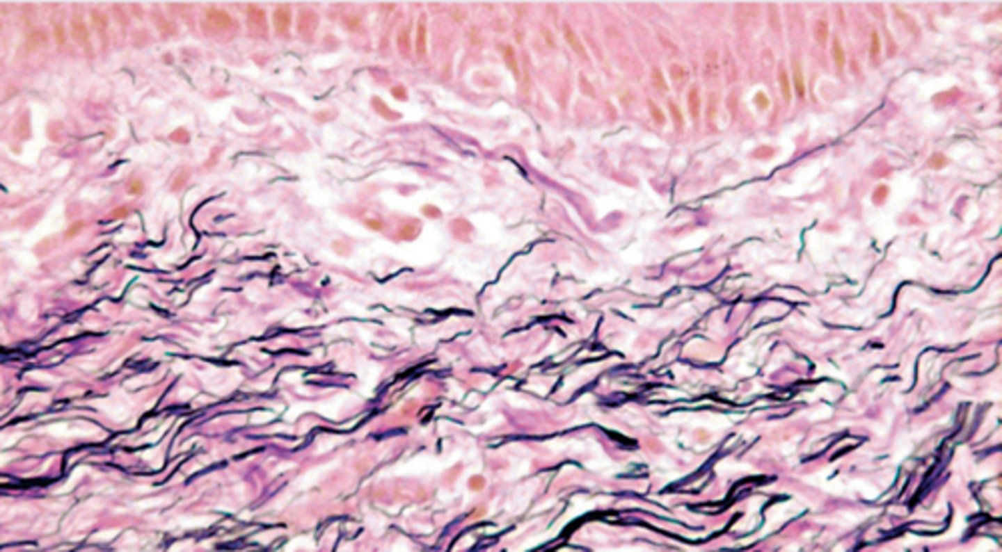 <p>To visualise Elastic Fibres.</p>