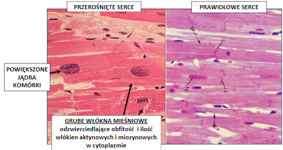 <p>kardiomiocyty są pogrubiałe i wydłużone wskutek syntezy nowych miofilamentów, jądra komórkowe ze zwiększoną ilością chromatyny przyjmują na przekroju kształt prostokąta lub kwadratu</p>