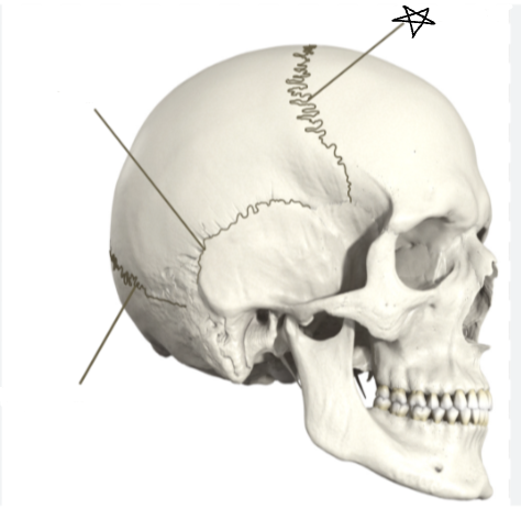 <p>what suture is the star pointing to </p>