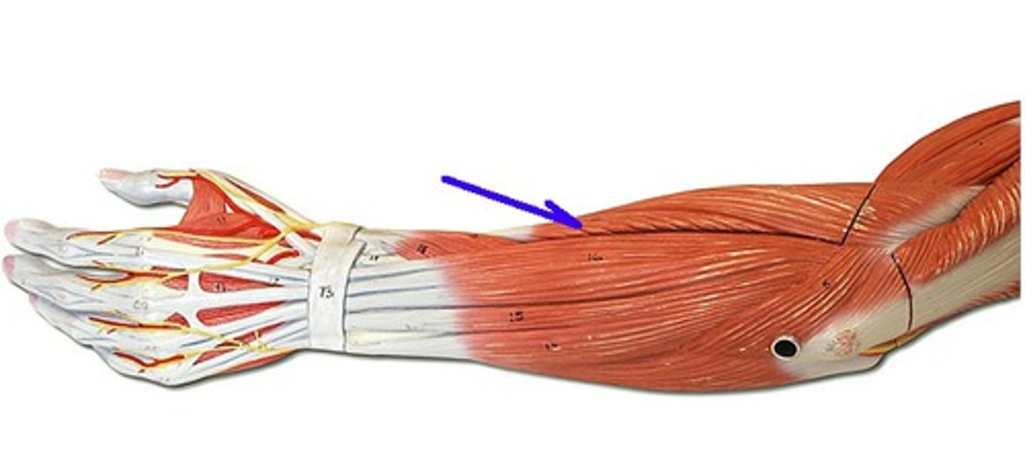 <p>Extends and abducts hand</p>