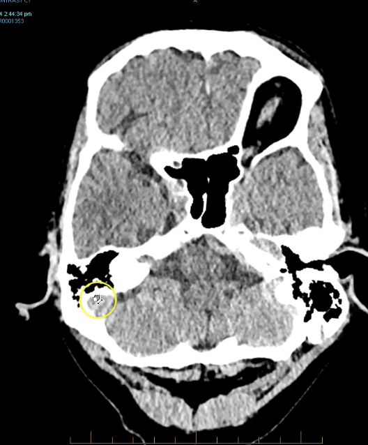 term image