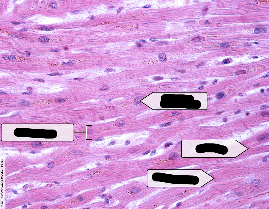 <p>What is this tissue?</p>