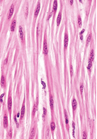 <p>What type of muscle is this?</p>