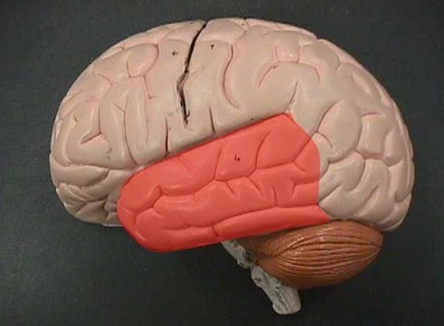 <p>Brain lobe that functions in the interpretation of auditory sensations - Memory storage of sounds and visual experiences</p>