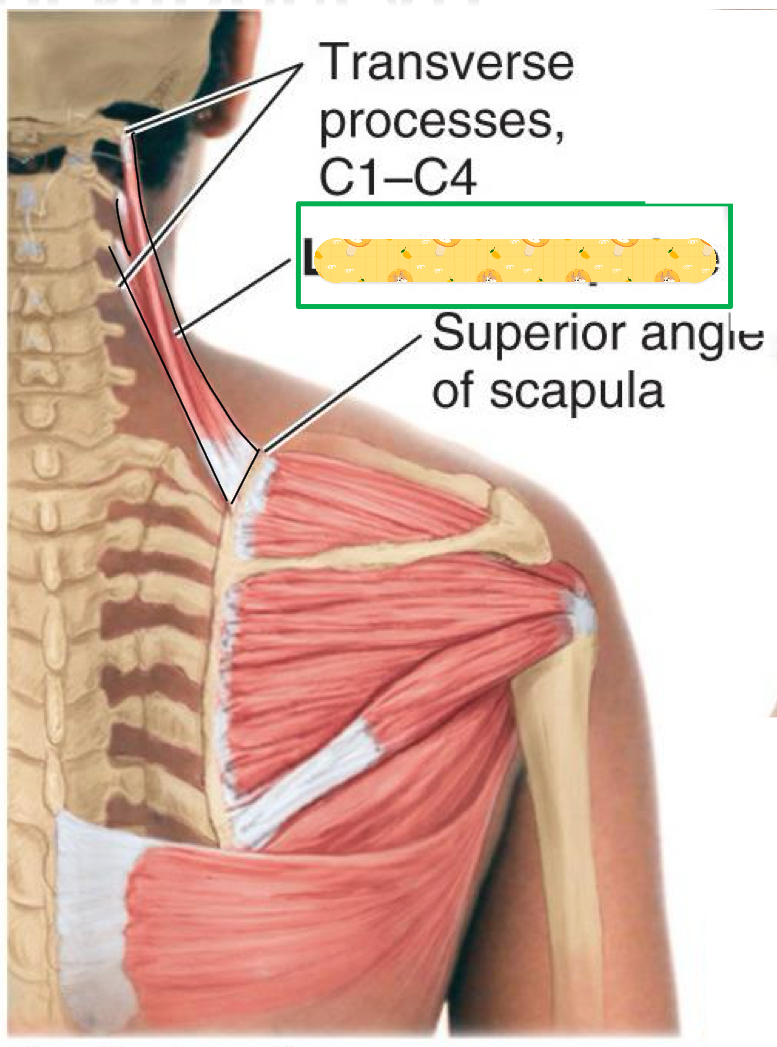 <p>Name this muscle</p>