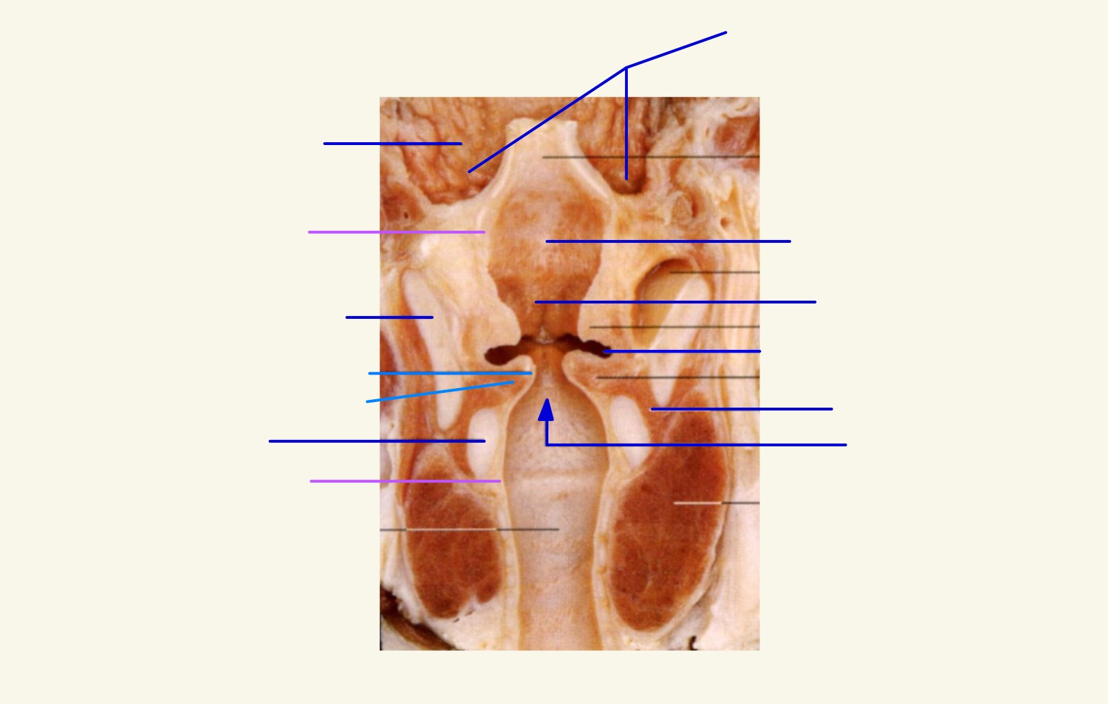 <p>Légender</p>