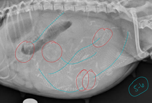 <p>Pregnancy on Radiographs </p>