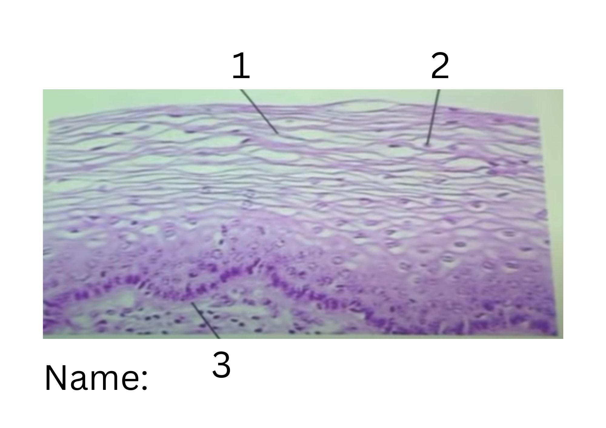 term image