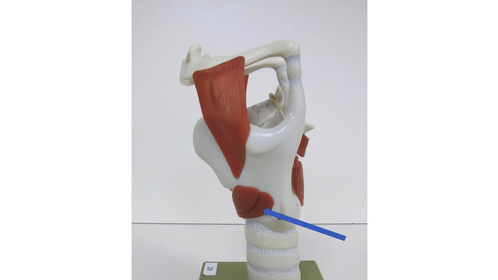 <p>lateraal zicht</p>