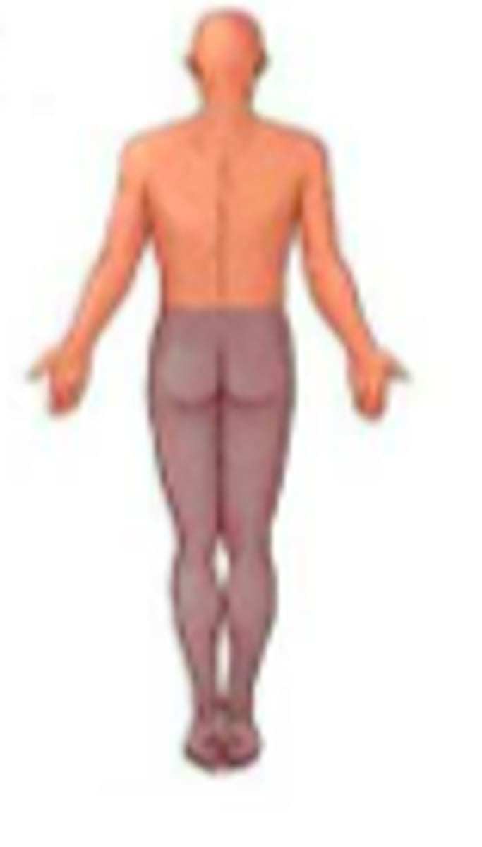 <p>damage to the thoracic or lumbar area of the spinal cord <br>-loose function to legs but not arms</p>