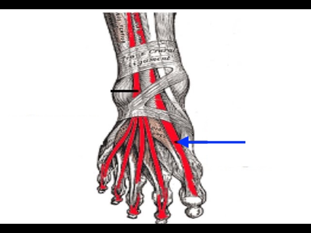 <p><span><span>A thin muscle in the front of your lower leg that extends (lifts up) your big toe (hallux) and helps lift your foot towards your shin (dorsiflexion)</span></span></p>