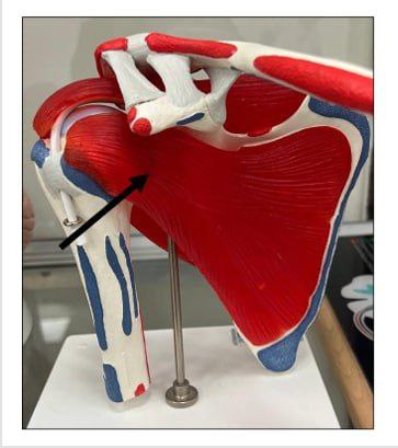 <p>Identify the joints in this picture and classify them</p>