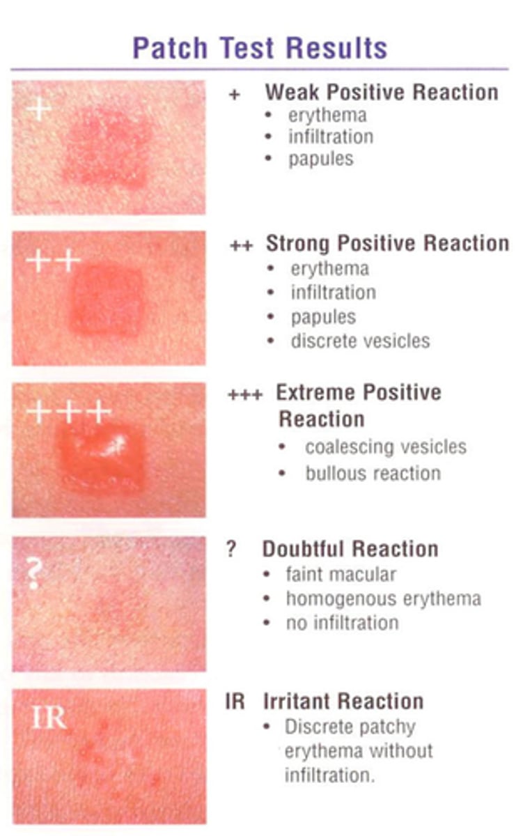 <p>Vesicles and bullae</p>