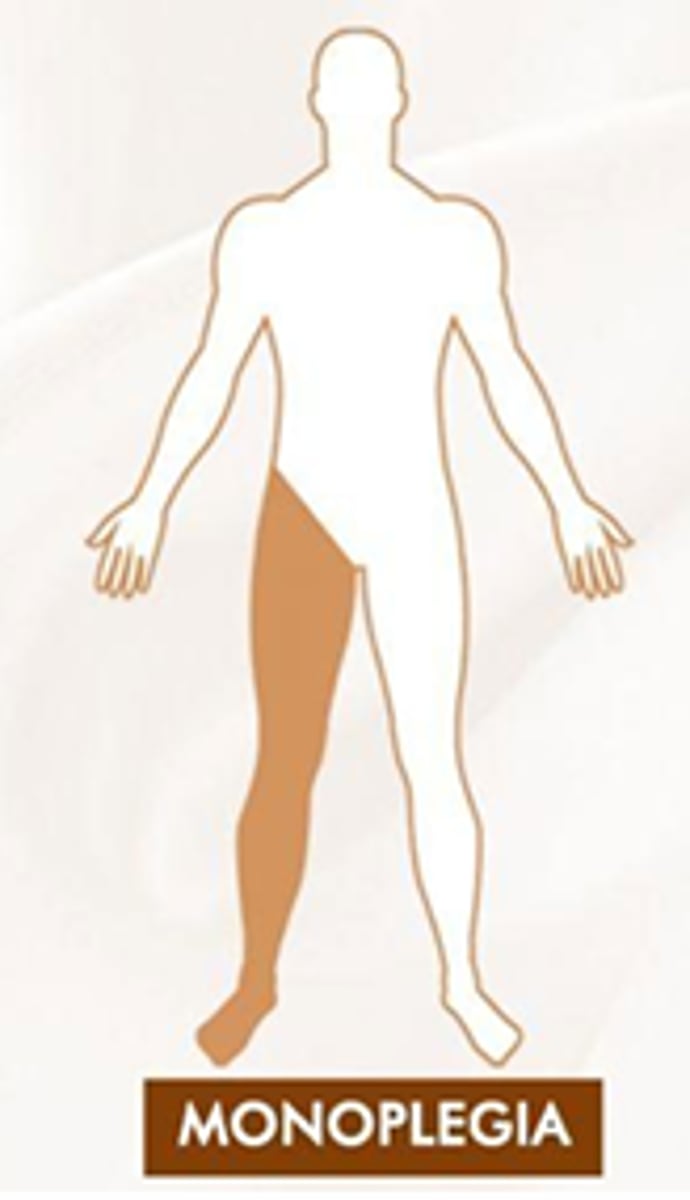 <p>One limb</p><p>Trauma or tumor</p>