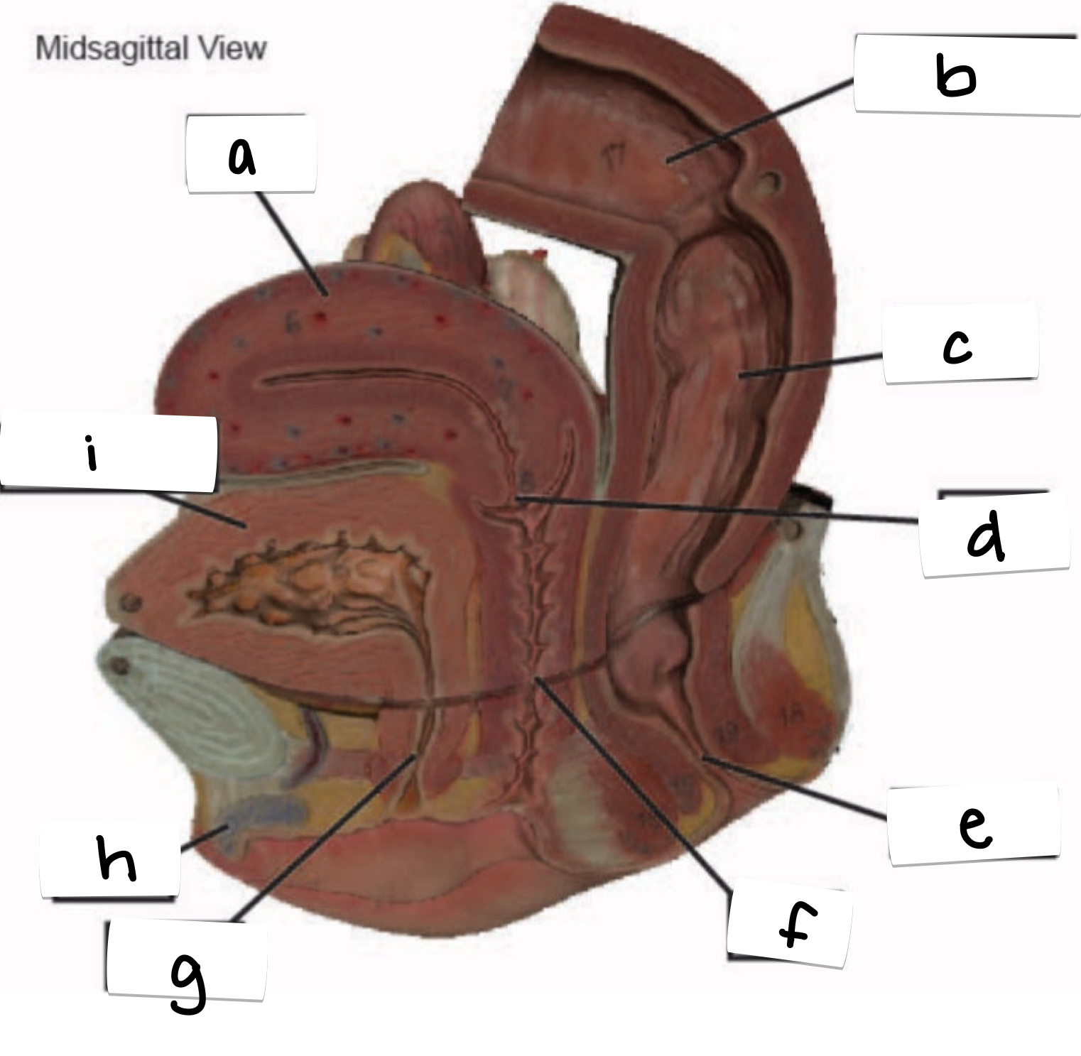 <p>what is labeled g on this midsagittal view of the female reproductive system?</p>