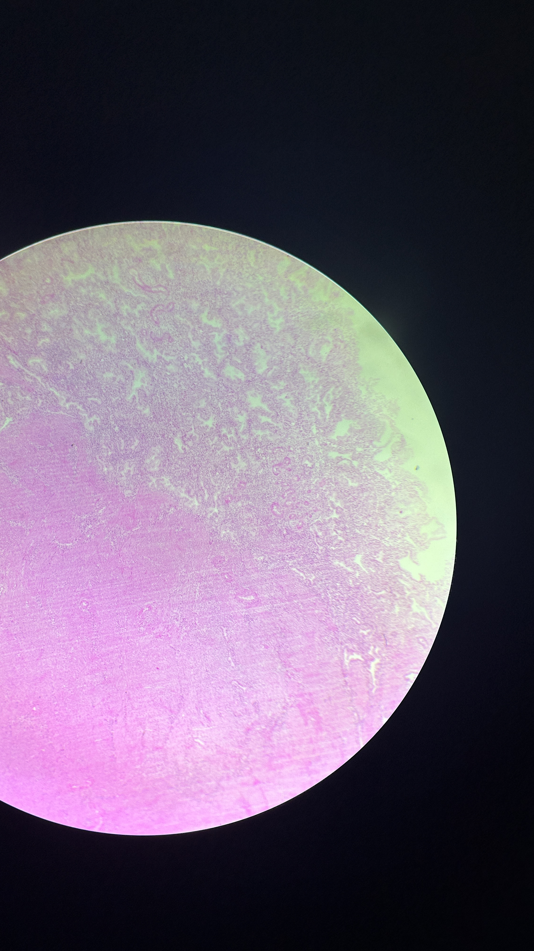 <p>What is the magnification level of the Smooth Muscle?</p>