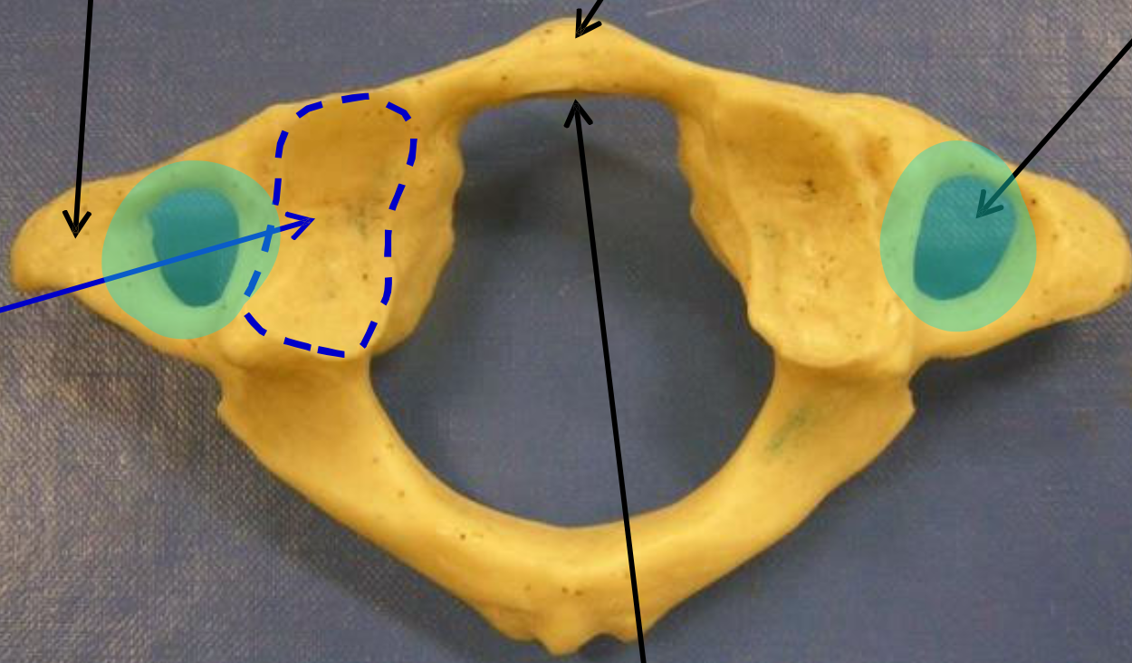 <p>Name the highlighted structure.</p>