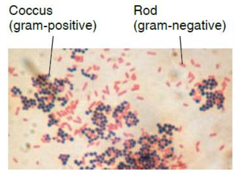 <ol><li><p>cover the heat-fixed smear with basic purple dye (crystal violet), referred to as primary stain</p></li><li><p>wash off the purple dye and the smear is covered with iodine, a mordant</p></li><li><p>wash the slide with alcohol or an alcohol-acetone solution (decolorizing agent) which removes the purple from the cells of some species&nbsp;</p></li><li><p>the alcohol is rinsed off then stained with safranin, a basic red dye</p></li><li><p>the smear is washed, blotted dry, and examined microscopically</p></li></ol><p></p>