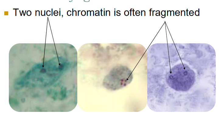 <ul><li><p><span>Size varies: 4-12; 5-15 um</span></p></li><li><p><span>20-40% of trophs have one nucleus</span></p></li><li><p><span><u>Karyosome often fragmented into 3-5 granules</u></span></p></li><li><p><span>No peripheral chromatin around nucleus</span></p></li><li><p><span>Cytoplasm is ‘dirty’</span></p><ul><li><p><span>May see vacuoles and granules</span></p></li></ul></li><li><p><span><strong><u>Will not</u></strong><u> be seen on wet preps or in concentrates</u></span></p></li></ul><p></p>