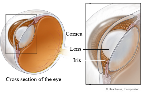 Why are there not blood vessels in the cornea or lens?