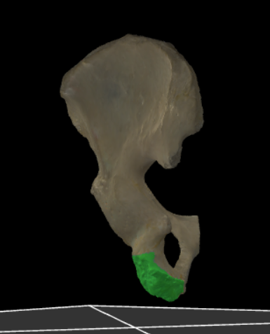 <p>De stevige knobbel die de grens vormt tussen het corpus en de ramus ossis ischii, essentieel voor de ondersteuning van het lichaamsgewicht tijdens zitten.</p>