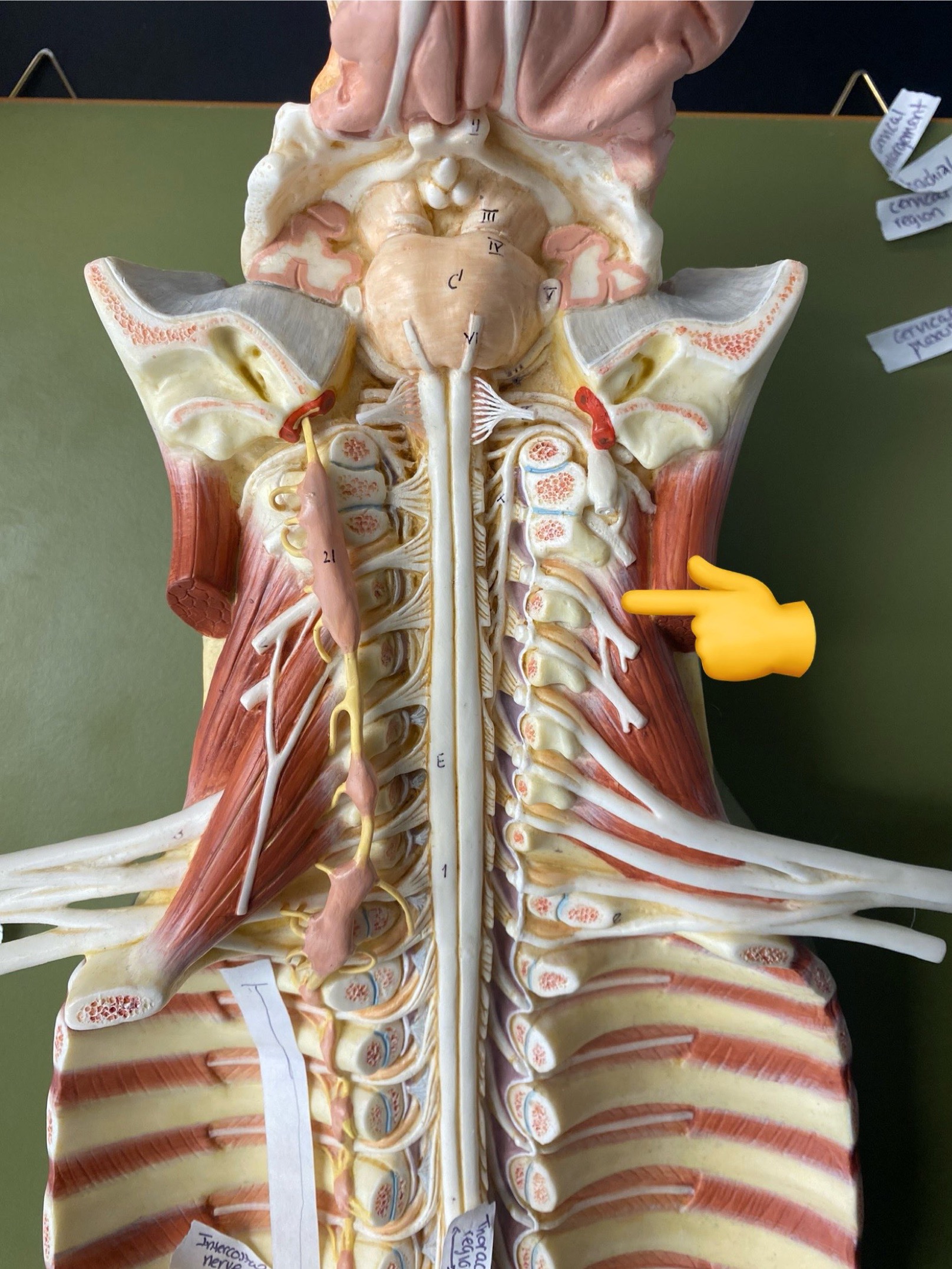 <p>ID plexus</p>