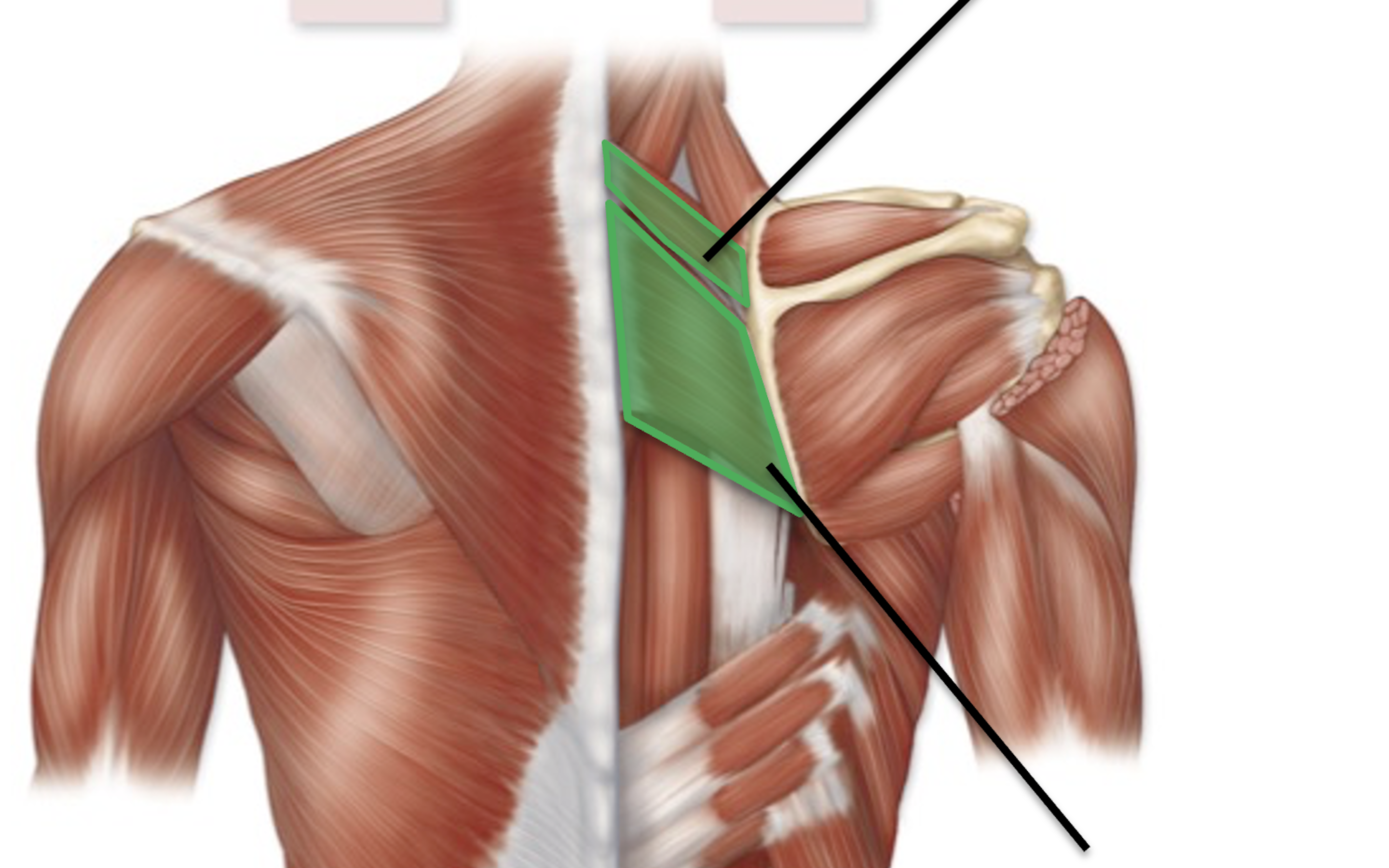 <p>What is the superior muscle that is highlighted in green.&nbsp;</p>